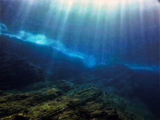 慢性病卡如何办理流程